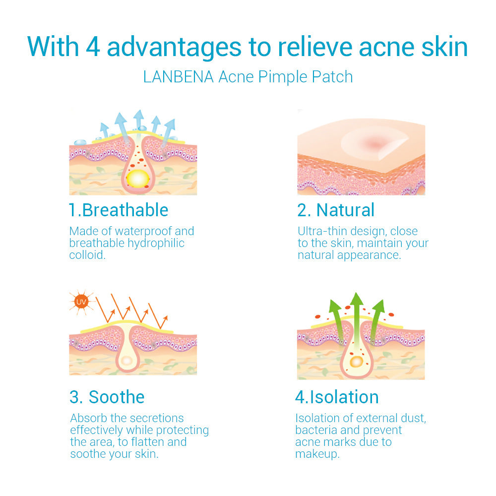 Acne stickers, fade, acne marks